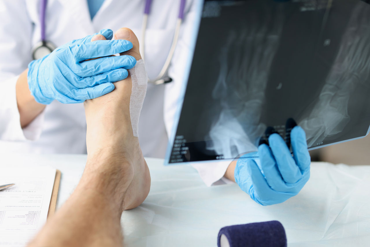 Traumatologist looking at xray of foot and examining patient