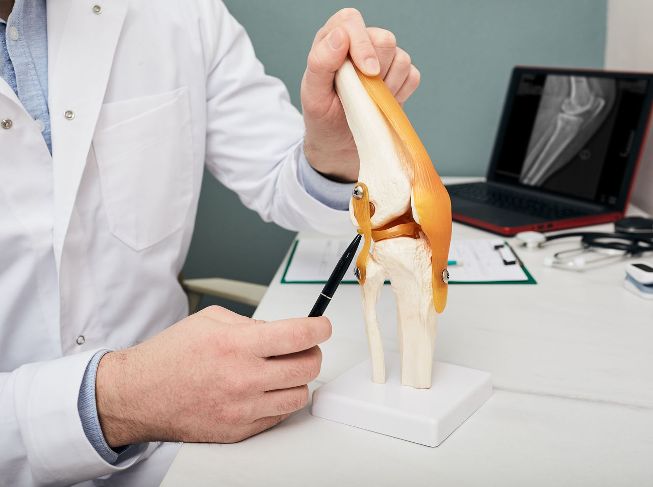 Human cruciate ligament injury treatment concept. Orthopedist showing to cruciate ligament in a knee-joint medical teaching model, close-up,Human cruciate ligament injury treatment concept. Orthopedist sh
