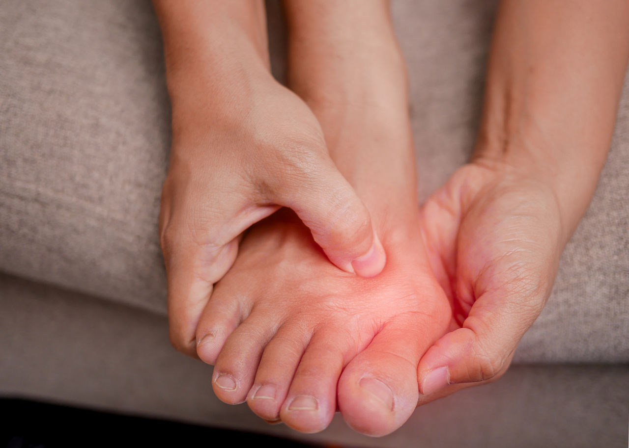 Closeup of female holding her painful feet and massaging her bunion toes to relieve pain. Swollen bunion at the edge of the big toe causes deformity (Hallux valgus). Woman's health concept.,Closeup of female holding her painful feet and massaging her bun